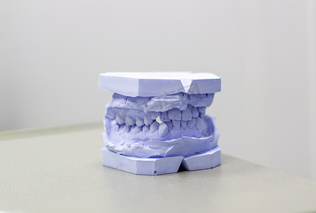 在正牙医生那里用石膏打出牙齿的石膏模型。