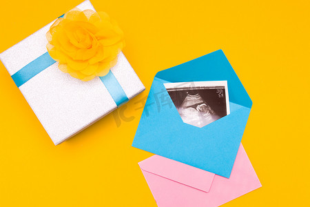 银盒中的超声波图片，带有蓝丝带和黄花黄色背景，复制顶视图，怀男孩或女孩的妇女，惊喜，照片作为礼物，怀孕概念