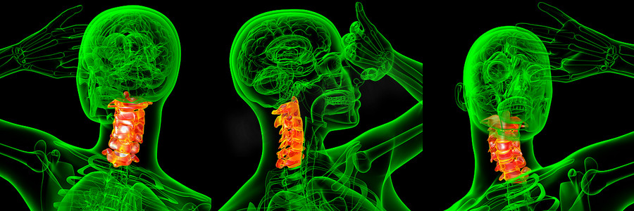 颈椎的 3d 渲染医学插图