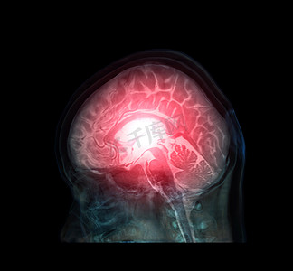 头骨与大脑的透明图像，用于医学背景概念。
