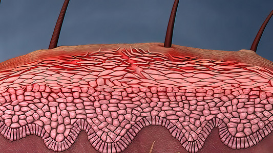 空气中细菌对皮肤伤口的攻击和免疫系统的激活