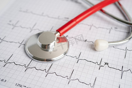 听诊器上心电图 (ECG)、心波、心脏病发作、心电图报告。