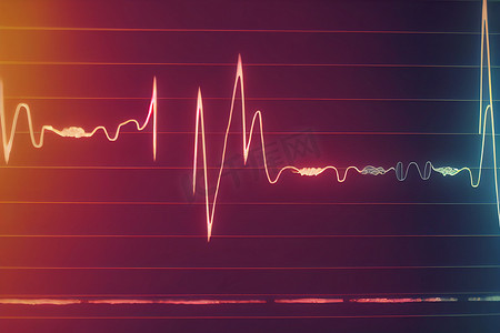体检摄影照片_心电图、心电图、心率监测仪显示病房内的特定疾病，用于检查住院患者的心率。