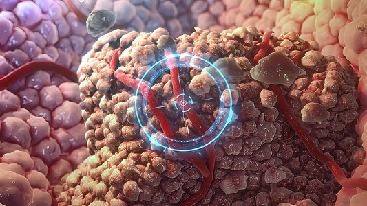 3D 插图免疫细胞摧毁癌细胞
