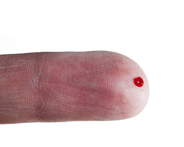 男性手指上有一滴血