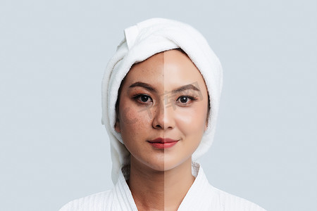 美丽的亚洲女人的比较肖像。黑斑和新皮肤，之前 - 皮肤护理和清洁概念后，美容治疗过程老化为振兴.