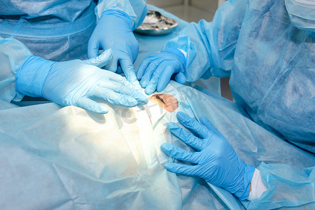 Close up of surgery team operating. The operation on the eye. Cataract surgery. Laser vision correction. Patient and team of surgeons in the operating room, patient under sterile cover