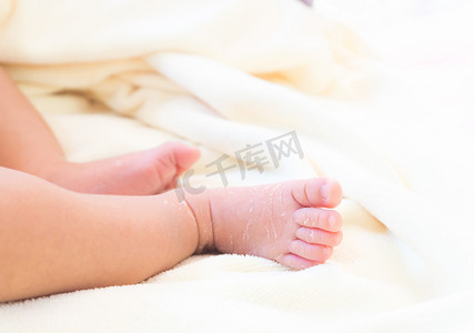 新生儿的特写腿, 皮肤脱皮在白布上, 保健和医疗概念, 选择性重点