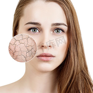 摄影照片_缩放圆圈显示干燥的面部皮肤滋润前.