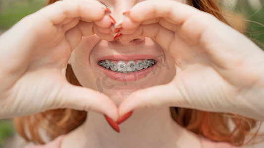 一位红头发的年轻女子的特写，她的牙齿上戴着牙套，双手合十，形似心脏。牙齿矫形器的完美微笑.