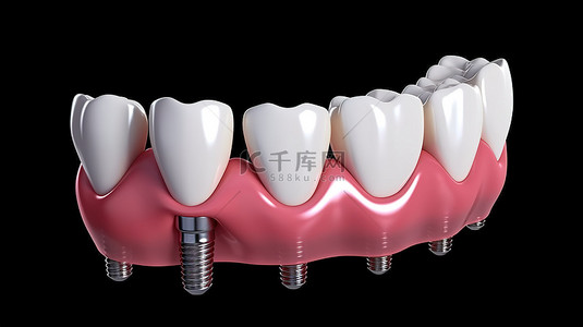 患者处理流程背景图片_用白牙处理的植入物的 3D 渲染，用于孤立的特写镜头