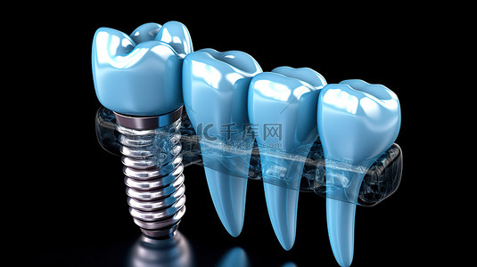 3D 牙科植入插图中蓝色透明组件的详细视图