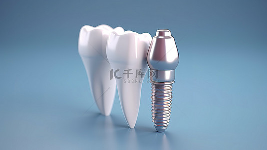 种植工具背景图片_牙种植体的 3D 可视化