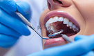 检查牙齿拔牙医疗