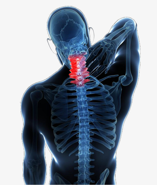 颈椎痛素材图片免费下载_高清装饰图案png