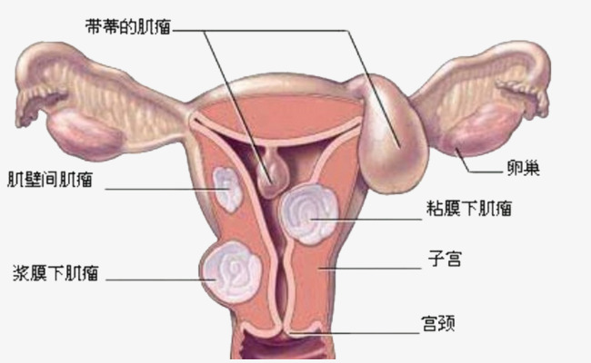 卵巢高清图