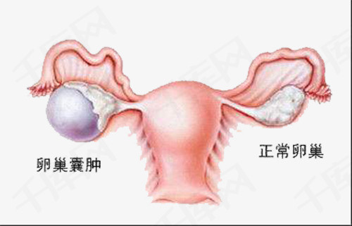 卵巢高清图