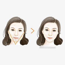 漫画瘦脸针前后对比图png