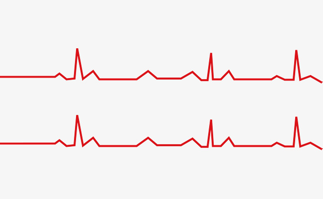 心跳折线