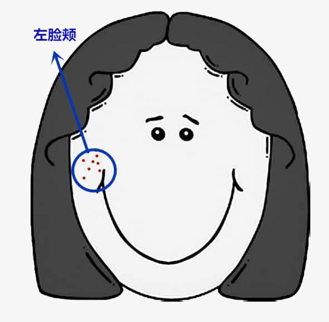 灰色短发长痘笑脸女孩左脸颊中分短发长痘痘大笑脸小眼睛
