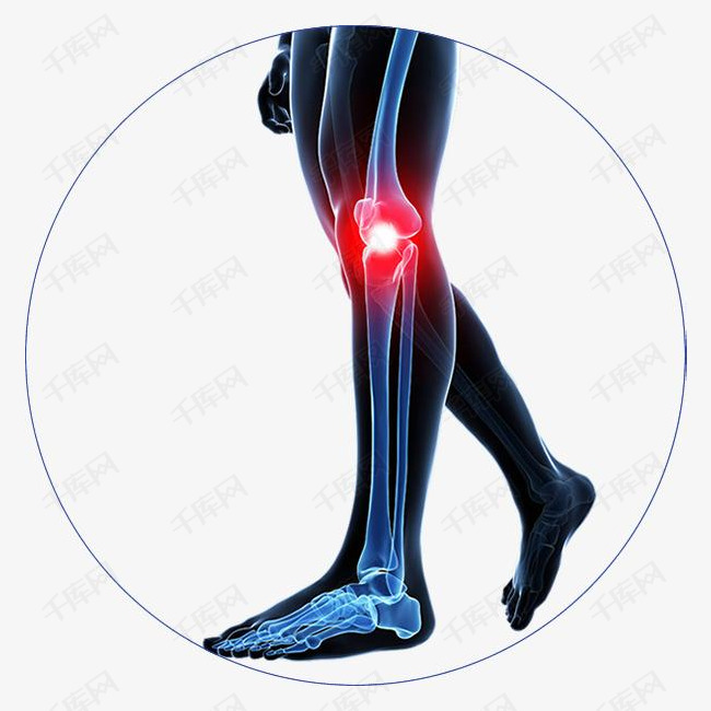 膝盖骨关节手绘图素材图片免费下载_高清png