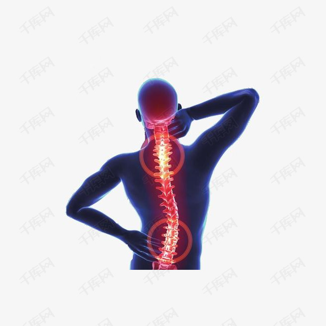 低头族引起颈椎疼痛图片素材图片免费下载_高