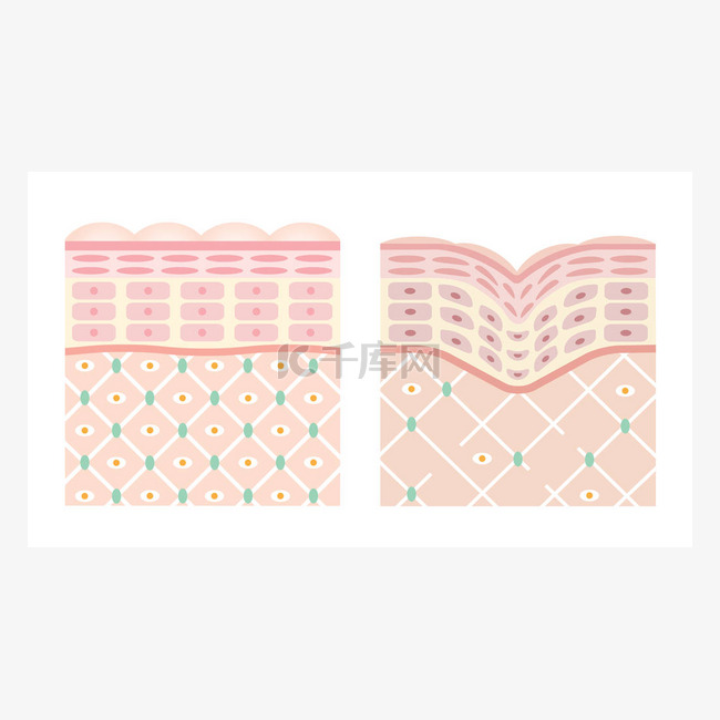 年轻的皮肤和老皮图