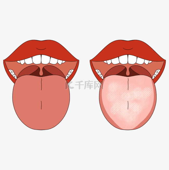 舌头口腔护理舌苔清洁对比
