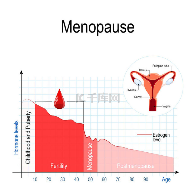 更年期图。雌激素水平和老化。更