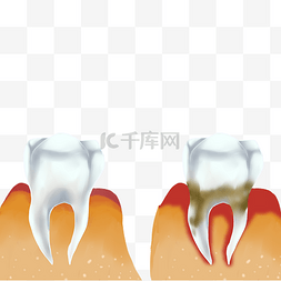 肿痛图片_牙周炎牙痛