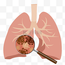 肺部吸氧图片_矢量感染肺部发现病毒