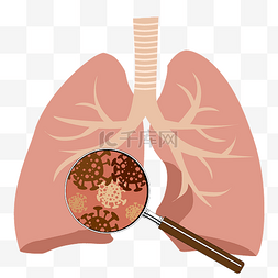 矢量肺部图片_矢量感染肺部发现病毒