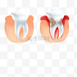 肿痛图片_牙周炎疾病