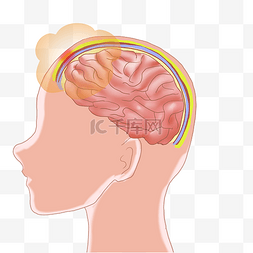脑医疗图片_人体脑组织脑膜炎