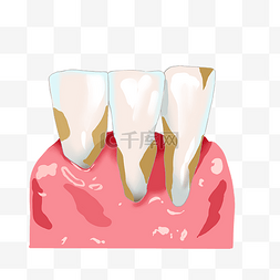 肿痛图片_牙周炎牙周病痛