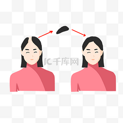 美容对比图片_女士植发人物