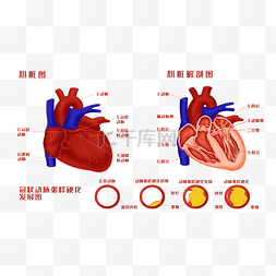 人头解剖图图片_人体器官心脏解剖图及冠状动脉粥