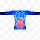 人体医疗肠胃疾病