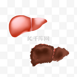 肝脏脏器肝硬化医疗器官肝脏内脏