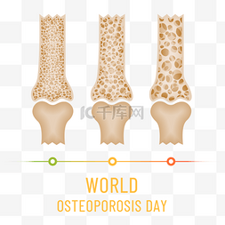 世界骨质疏松日逐渐疏松严重的骨