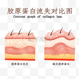 皮肤构造图片_皮肤问题胶原蛋白流失剖面图