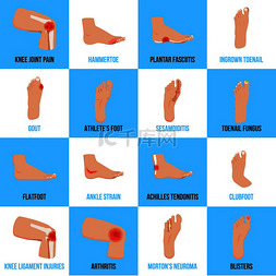 面图片_足部问题平面图标集