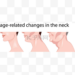 颈部与年龄有关的变化，颈部皮肤