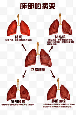 人体五脏六腑图片_人体医疗组织器官人体肺部病变