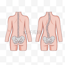 腰椎负重图片_脊柱侧弯矫正健身