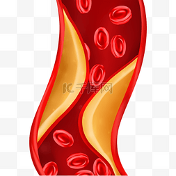 人体的血管图片_血管堵塞血液不能流动
