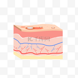 皮肤结构图片_皮肤问题立体剖面图结构暗疮