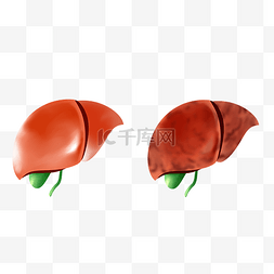 肝癌图片_人体脏器肝硬化医疗器官肝脏内脏