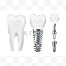 牙科手术。种植切割和健康的牙齿