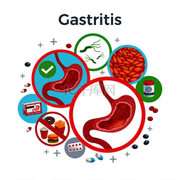 健康和不健康图片_胃炎疾病症状引起药物扁平圆形组
